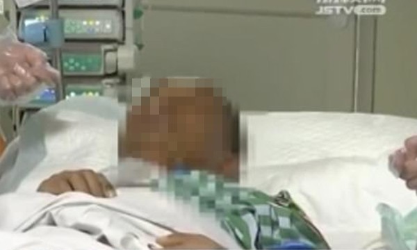 Nặn mụn từ lần này sang lần khác, một người bị biến chứng viêm phổi kép, xẹp cả 2 bên phổi ảnh 1