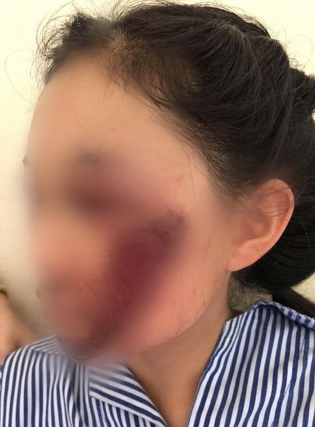 Hiểm họa rình rập từ những trang phục chống nắng của hội chị em khi tham gia giao thông ảnh 1