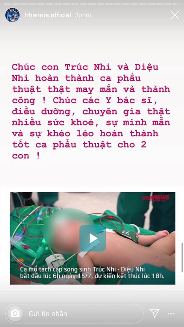 Sao V-Biz gửi lời chúc tốt đẹp tới hai bé song sinh dính liền được phẫu thuật tách rời ảnh 4