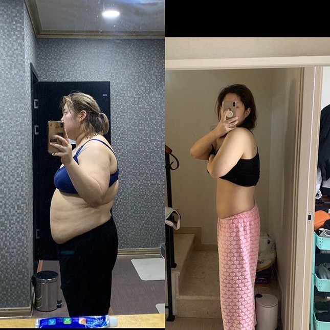 “Thánh ăn” Yang Soo Bin mắc ung thư tuyến giáp do thừa cân hay giảm cân quá nhanh? ảnh 1
