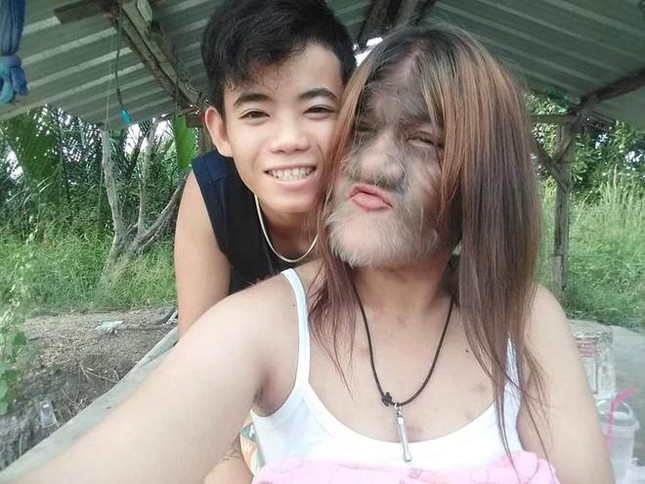Vừa chia tay chồng sắp cưới, “cô gái người sói” Thái Lan khoe ảnh bên bạn trai mới ảnh 2