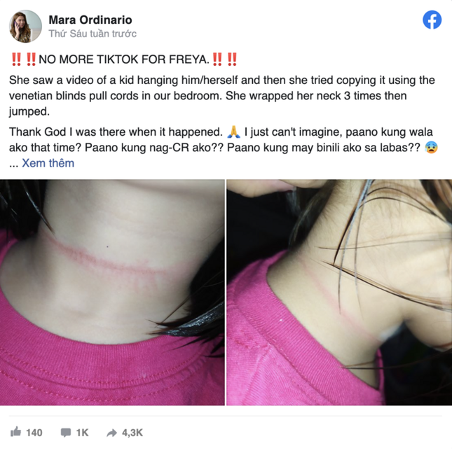 Bé gái 4 tuổi ở Philippines suýt mất mạng khi thực hiện theo thử thách treo cổ trên TikTok ảnh 1
