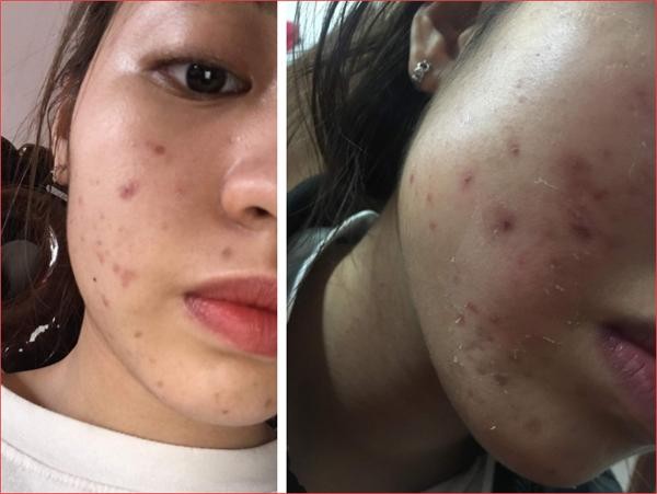 Hot TikToker “trứng rán cần mỡ” vẫn bị dân mạng nghi ngờ dù đã can đảm công khai mặt mộc ảnh 3