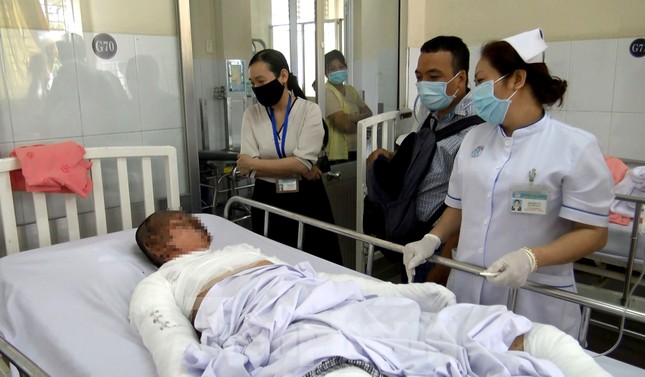 Cháy toàn thân, hỏng mắt do lên mạng học cách chế pháo nổ chơi Tết ảnh 1