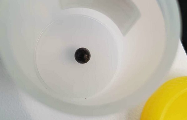 Bé trai nghịch súng bị đạn xuyên thủng lưng ảnh 1