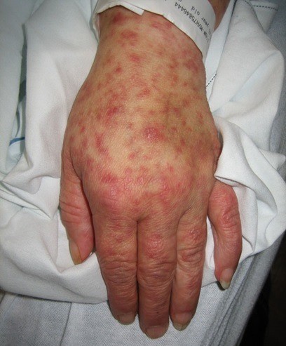Mỹ: COVID-19 đang ' rất nóng', lại phát hiện thêm virus cực độc ảnh 1