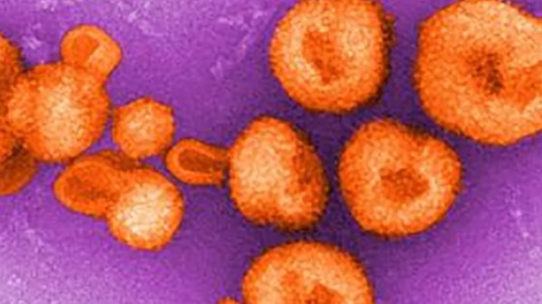 Mỹ: COVID-19 đang ' rất nóng', lại phát hiện thêm virus cực độc ảnh 2