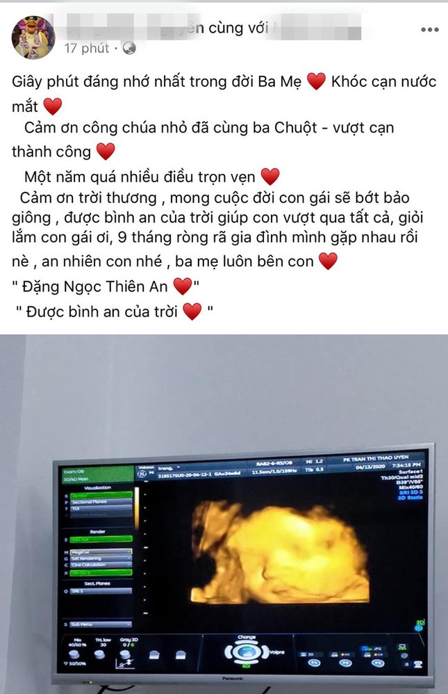 Việt Nam ghi nhận thêm 2 ca mắc mới COVID-19 từ nước ngoài về ảnh 2