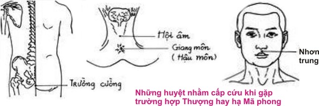Đột tử khi sinh hoạt tình dục và cách xử lý sự cố ảnh 1