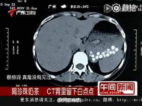 Hãi hùng trà sữa trân châu làm từ đế giày và bỉm trẻ em ảnh 1