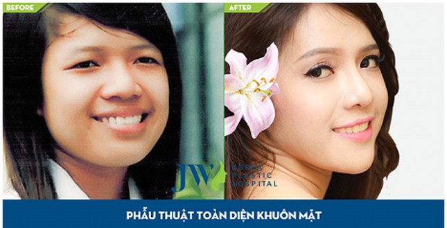 Cơ hội làm đẹp miễn phí đến 500 triệu đồng chỉ 1 ngày duy nhất ảnh 1