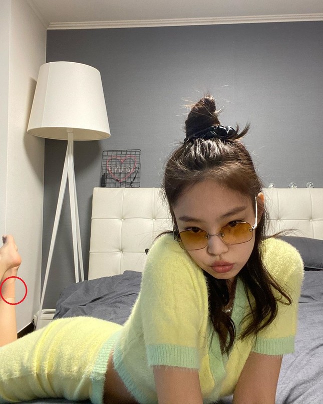 Fans lo lắng vì Jennie (Black Pink) lộ thân hình mỏng dính, chân bị thương phải đi nạng ảnh 2