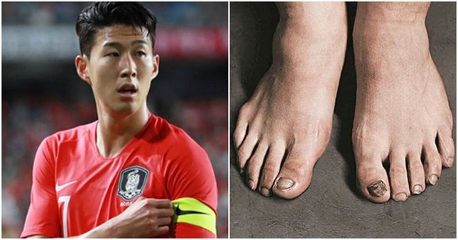 Son Heung-Min và hệ quả cho suất miễn nghĩa vụ quân sự Hàn Quốc ảnh 1
