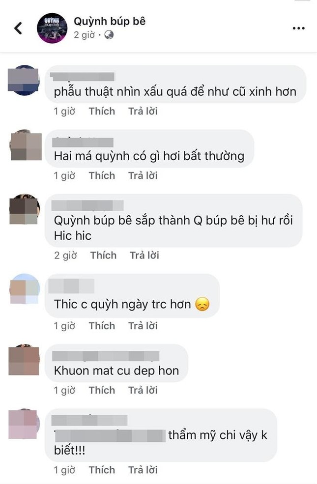 Nữ chính "Quỳnh Búp Bê" gây sốc với gương mặt “dao kéo” bị ví như “búp bê hư” ảnh 6