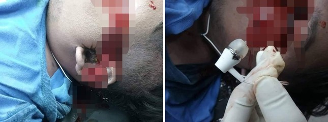 Người mẹ phát hiện con trai tử vong vì đeo tai nghe trong lúc sạc điện thoại rồi đi ngủ ảnh 2