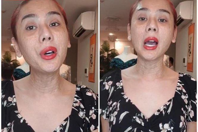 Lâm Khánh Chi tái xuất với nhan sắc không ngờ sau khi lộ ảnh mặt sần sùi - ảnh 5
