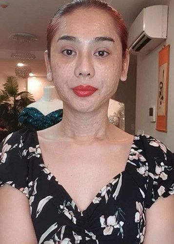 Lâm Khánh Chi tái xuất với nhan sắc không ngờ sau khi lộ ảnh mặt sần sùi - ảnh 6