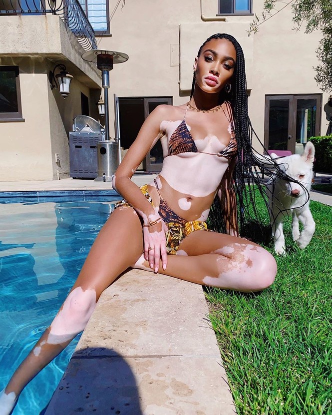 Winnie Harlow diện bikini thả dáng quyến rũ bên bể bơi - ảnh 1