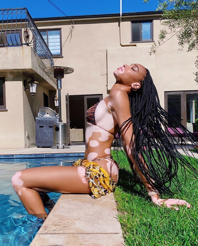 Winnie Harlow diện bikini thả dáng quyến rũ bên bể bơi - ảnh 2