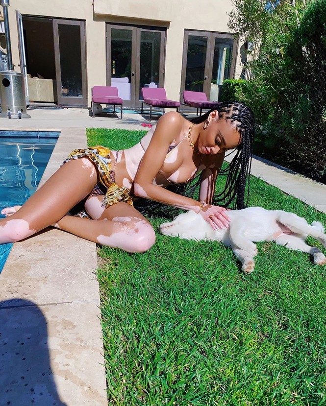 Winnie Harlow diện bikini thả dáng quyến rũ bên bể bơi - ảnh 3