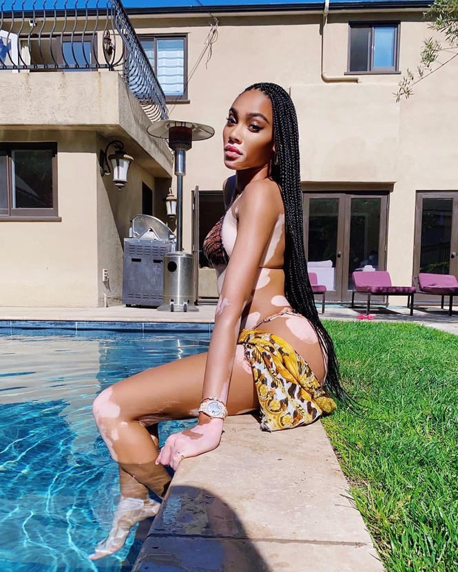 Winnie Harlow diện bikini thả dáng quyến rũ bên bể bơi - ảnh 4
