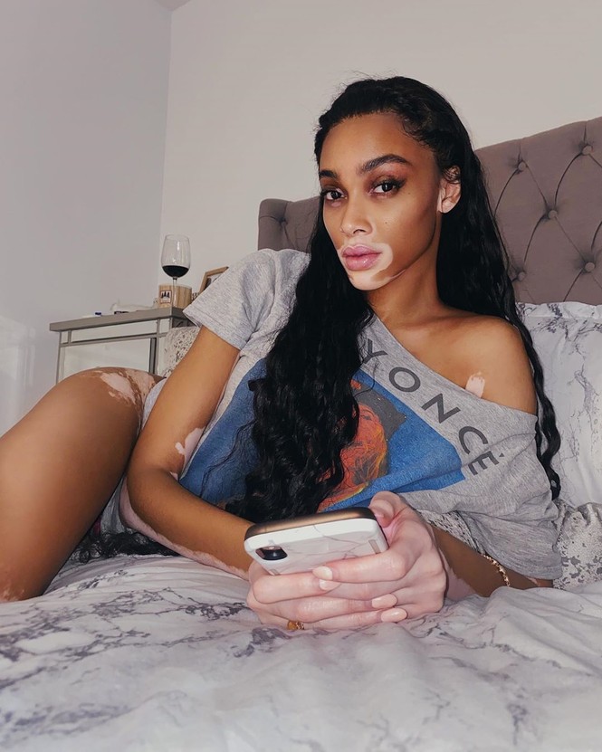 Winnie Harlow diện bikini thả dáng quyến rũ bên bể bơi - ảnh 5