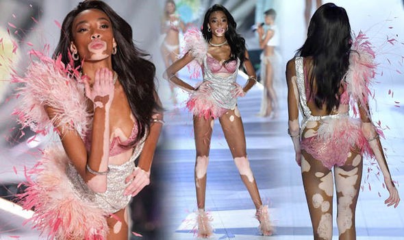 Winnie Harlow diện bikini thả dáng quyến rũ bên bể bơi - ảnh 6