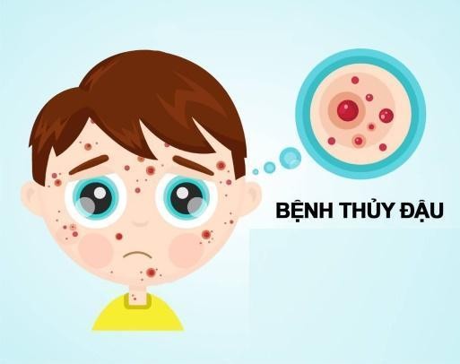 Làm sao để kiểm soát các bệnh ngoài da do virus - ảnh 1
