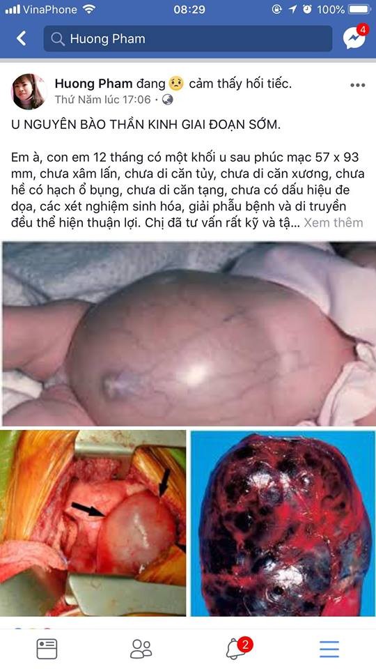 Bác sỹ 'kêu cứu' vì mẹ bệnh nhi ung thư từ chối điều trị cứu con - ảnh 1