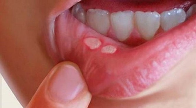Những người này ăn dưa hấu có thể mất mạng - ảnh 2