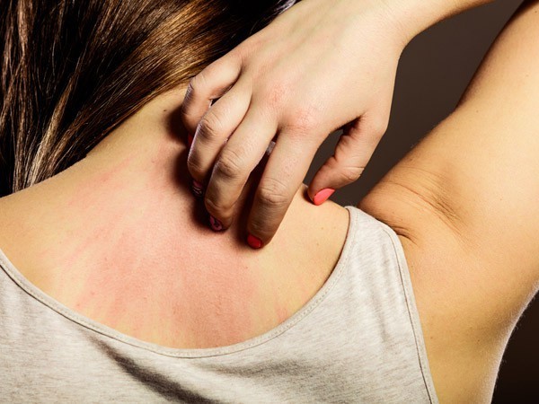 Dấu hiệu cơ thể bạn đang chứa đầy độc tố, đến viện 'nhanh còn kịp' - ảnh 2