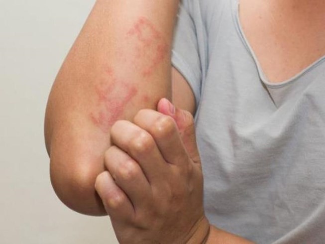 Những loại thuốc 'cứu mạng' cần mang theo khi đi du lịch - ảnh 2