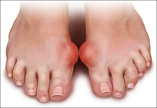 Dấu hiệu từ bàn chân cảnh báo bạn có thể đang mang 'trọng bệnh' - ảnh 2