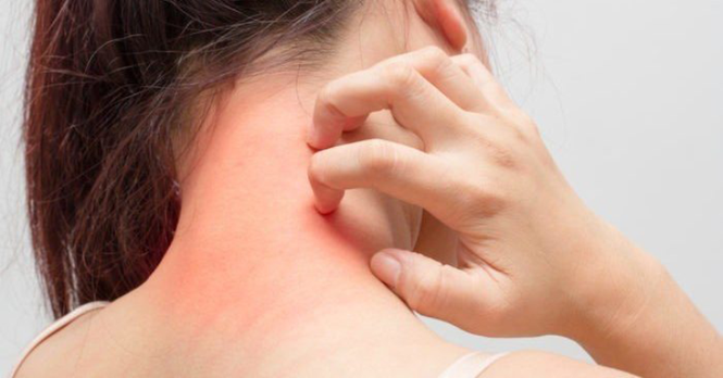 Khám ung thư gan ngay khi thấy cơ thể có những dấu hiệu này - ảnh 3