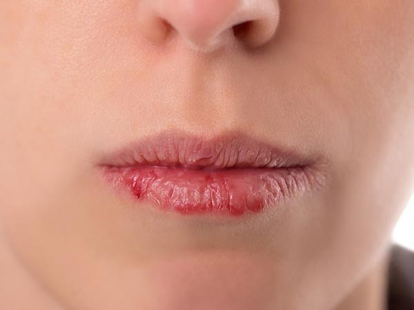 Dấu hiệu trên mặt cảnh báo bệnh nguy hiểm, đừng bỏ qua mà 'hối không kịp' - ảnh 1