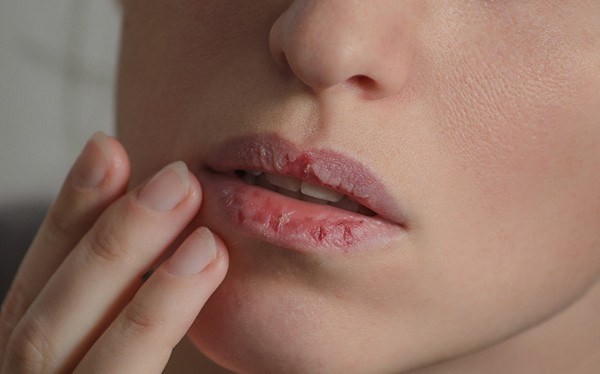 Dấu hiệu gan đang 'kêu cứu', đừng bỏ qua kẻo 'hối không kịp' - ảnh 3