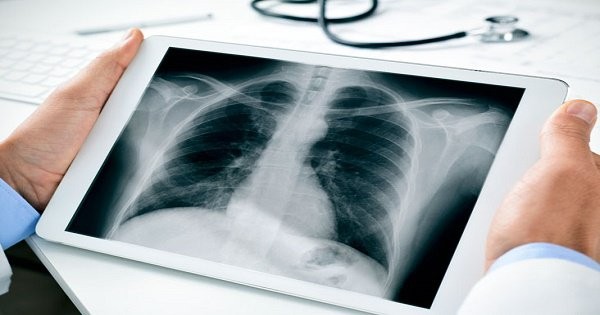 Lưng có những dấu hiệu này đi khám ung thư ngay kẻo muộn - ảnh 3