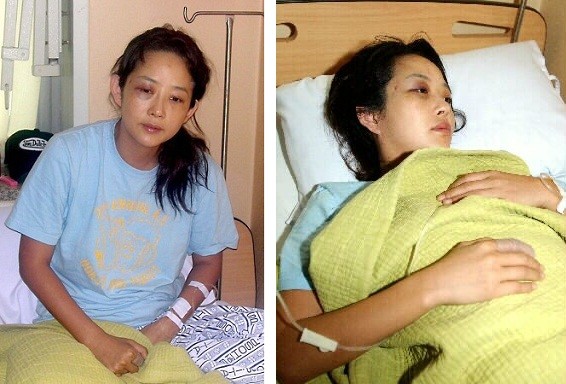 Những sao nữ châu Á từng bị chồng bạo hành dã man trong nhiều năm - ảnh 2