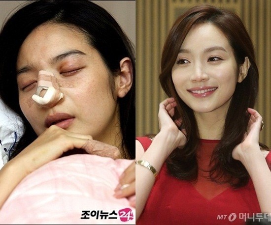 Những sao nữ châu Á từng bị chồng bạo hành dã man trong nhiều năm - ảnh 3