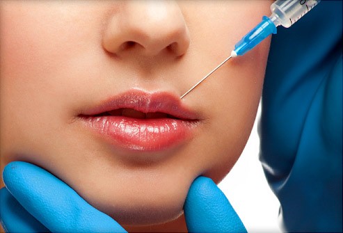 Tại sao mọi người đều tiêm filler làm đầy môi? Những khao khát dấu đằng sau mốt môi dày - ảnh 1