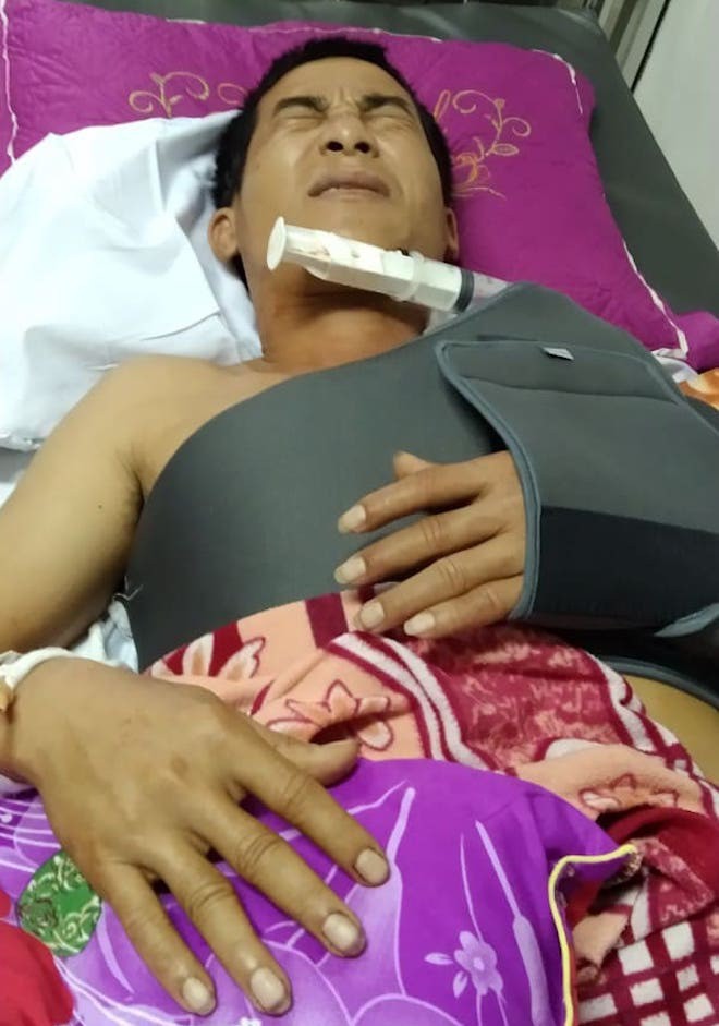 Xe tải làm đứt dây mạng, chủ nhà chém tài xế nhập viện - ảnh 1