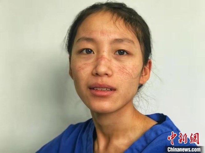 Xúc động nữ y tá hôn bạn trai qua tấm kính cách ly giữa mùa dịch corona - ảnh 4
