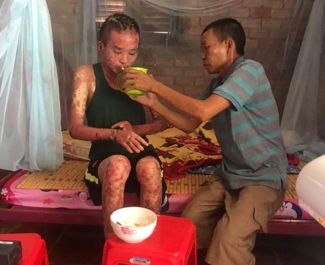 Kêu gọi hỗ trợ cho sinh viên bị bệnh nặng - ảnh 1