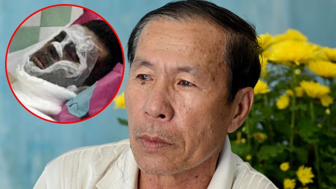 Vụ tạt axit, cắt gân chân Việt kiều: Bất ngờ lời kể của cha nạn nhân - ảnh 1