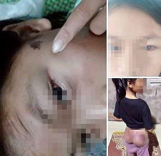 Công an viên trần tình việc còng tay, đánh bầm tím bé gái 12 tuổi - ảnh 1