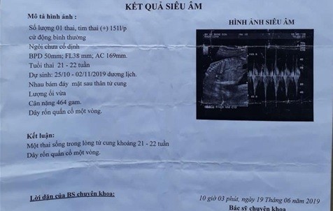 Bé gái 14 tuổi ở Bình Định bị xâm hại, mang thai 6 tháng - ảnh 1