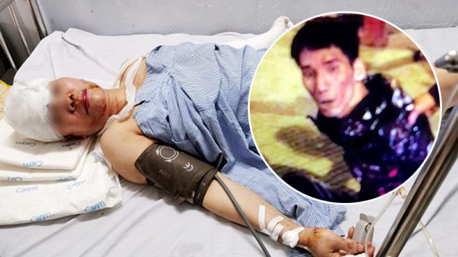 Kinh hoàng cảnh chủ nhà nghỉ bị chém hàng trăm nhát trong đêm - ảnh 1