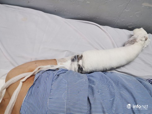 Kinh hoàng cảnh chủ nhà nghỉ bị chém hàng trăm nhát trong đêm - ảnh 2