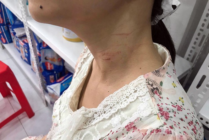 Hơn một giờ kinh hoàng của 3 người bị gã 'ngáo đá' dùng băng dính trói chặt, kề dao vào cổ - ảnh 1