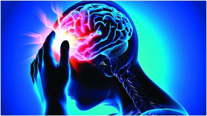 Dược Hậu Giang và bài toán hóa giải nỗi lo đột quỵ ngày càng trẻ hóa - ảnh 1